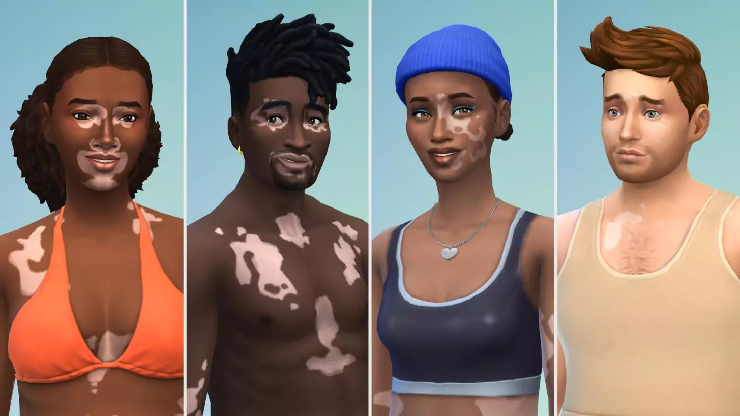 Vitiligo em The Sims 4