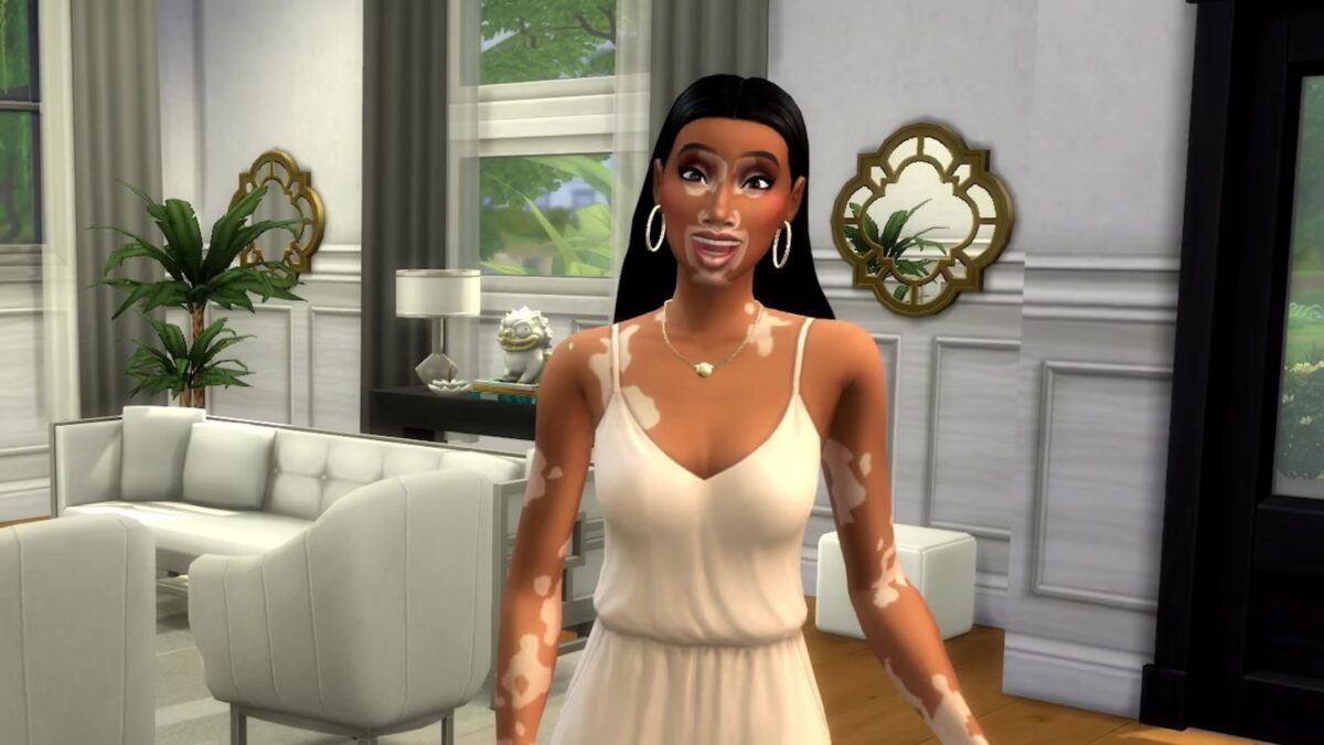 The Sims 4: agora &eacute; poss&iacute;vel adicionar vitiligo ao seu Sim