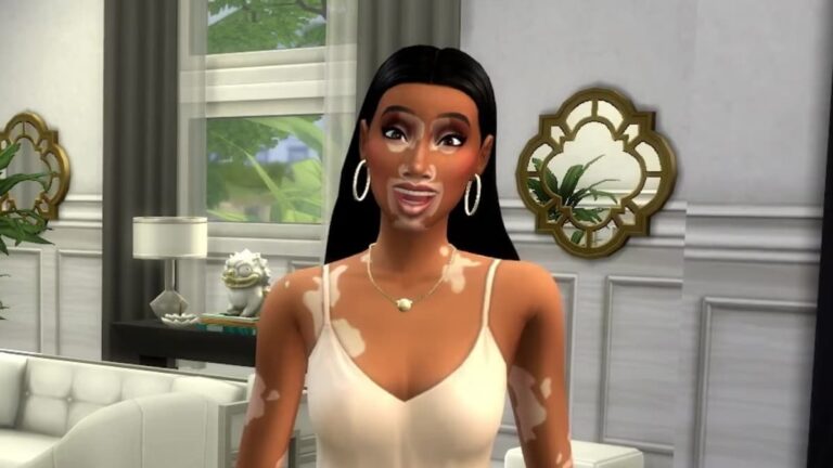 The Sims 4: agora &eacute; poss&iacute;vel adicionar vitiligo ao seu Sim